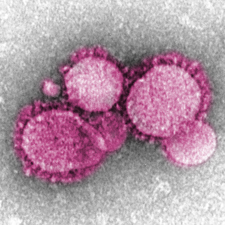 The illness caused by the novel coronavirus was named Coronavirus Disease, or COVID-19, in February. 